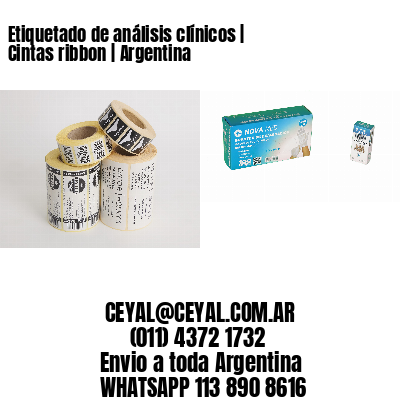 Etiquetado de análisis clínicos | Cintas ribbon | Argentina